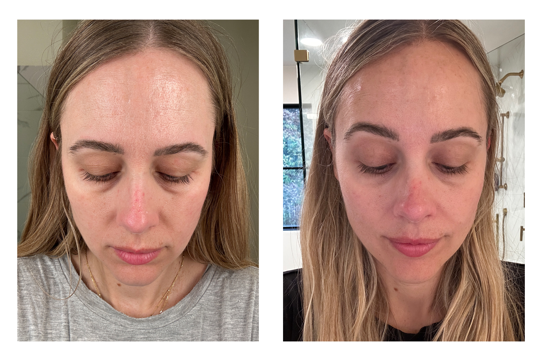 My ZO Skin Health Routine Plus Before After Pictures Fashion Jackson